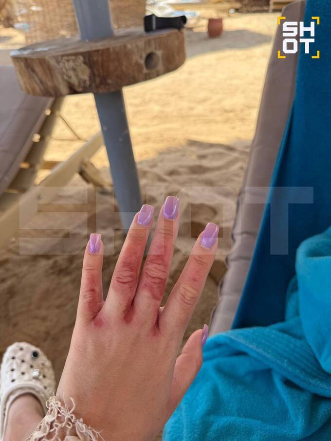 Туристы в Египте не могут зайти в воду из-за нашествия медуз